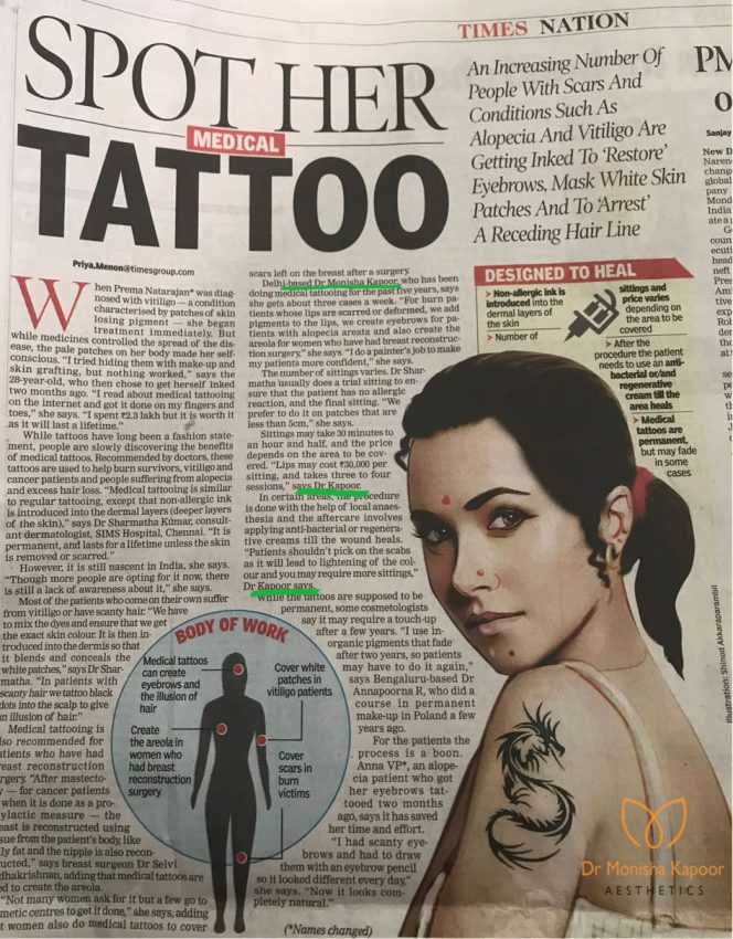 Spot Her Medical Tattoo