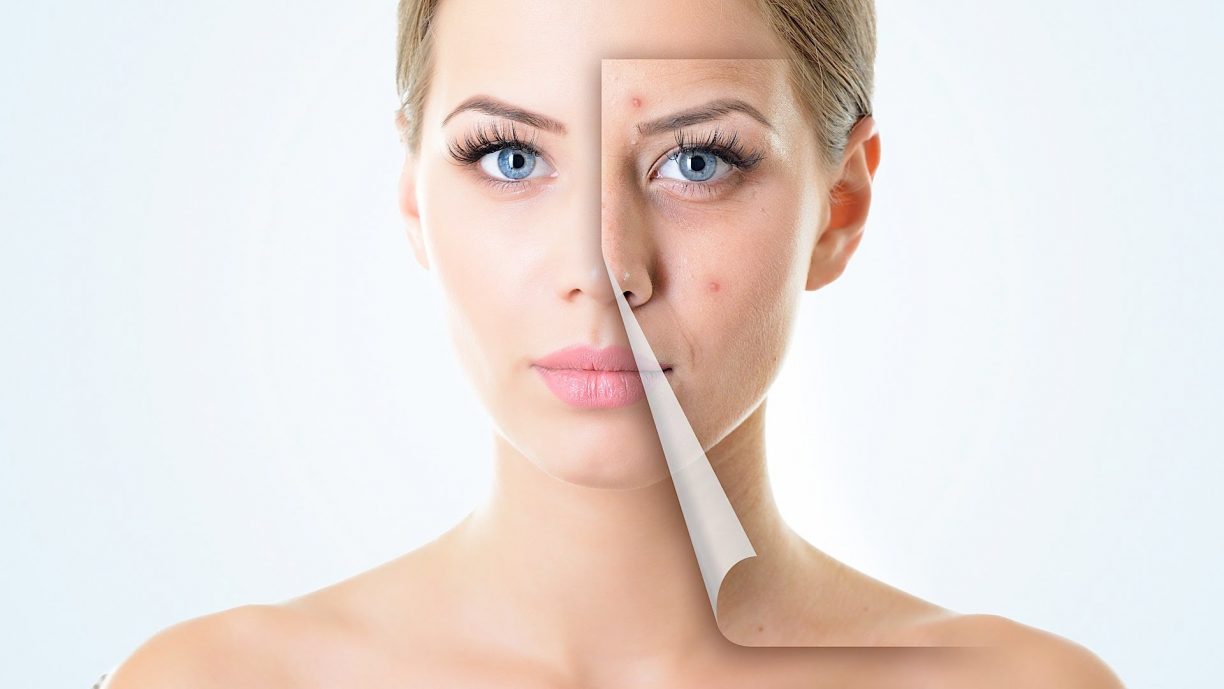 Medical treatment to reduce skin pigmentation