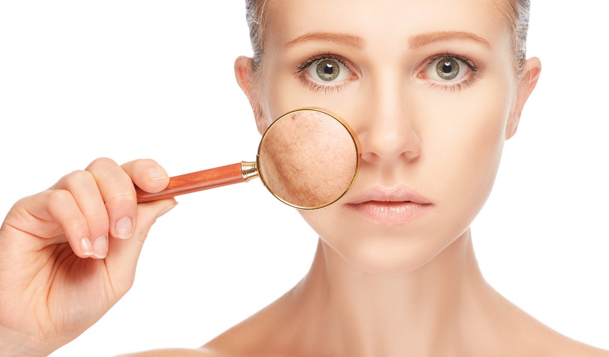 how to reduce skin pigmentation