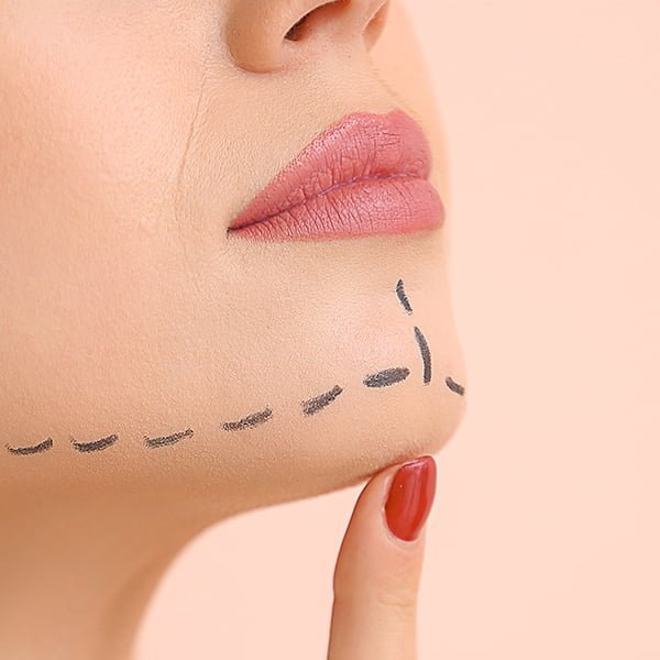 Double Chin Removal in Delhi (India)