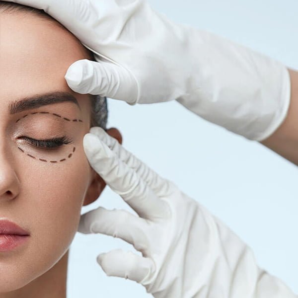 Eyelid Surgery in Delhi