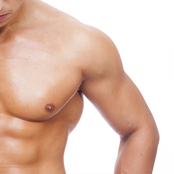 Male Chest Reshaping