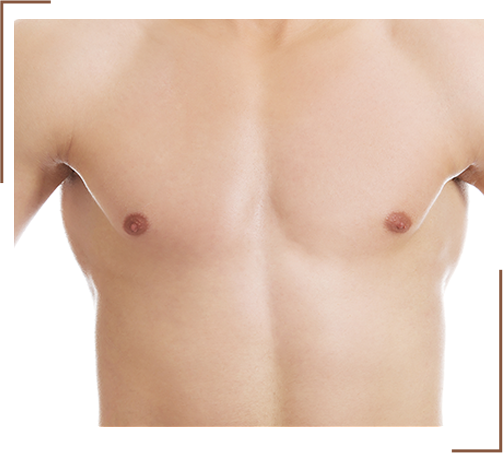 chest Reshaping