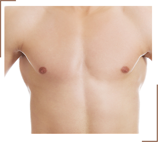 chest Reshaping