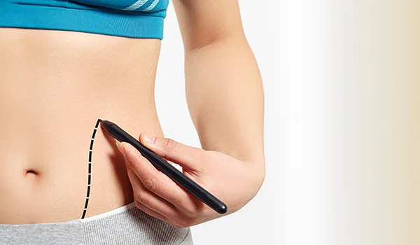 Liposuction Surgery in Delhi