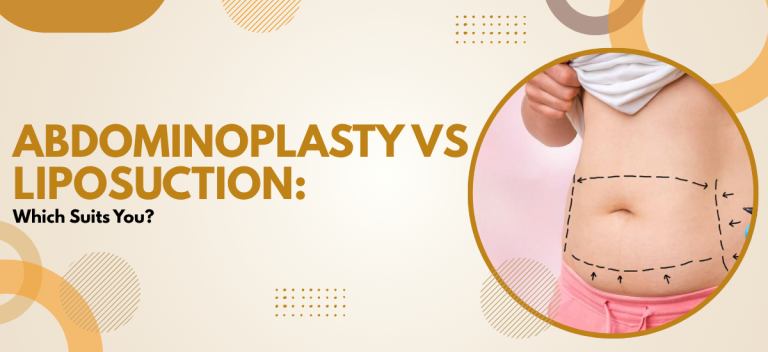 Abdominoplasty vs Liposuction: Which Suits You?