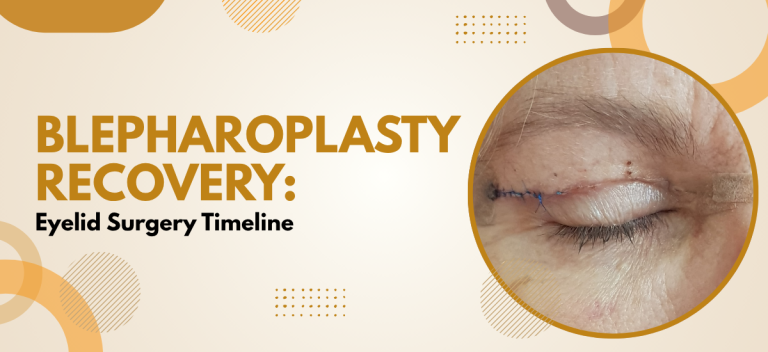 Blepharoplasty Recovery: Eyelid Surgery Timeline