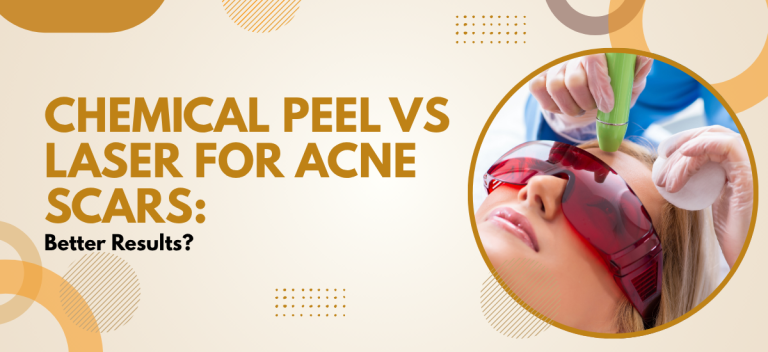 Chemical Peel vs Laser for Acne Scars: Better Results?