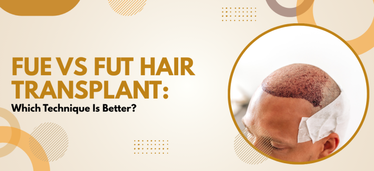 FUE vs FUT Hair Transplant: Which Technique Is Better?