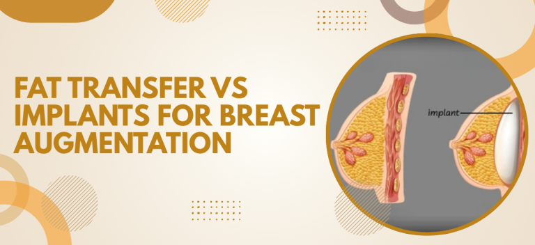 Fat Transfer vs Implants for Breast Augmentation