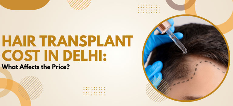 Hair Transplant Cost in Delhi: What Affects the Price?