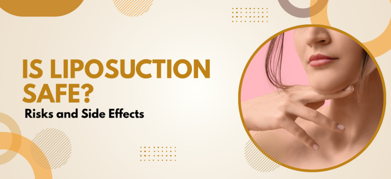 Is Liposuction Safe? Risks and Side Effects