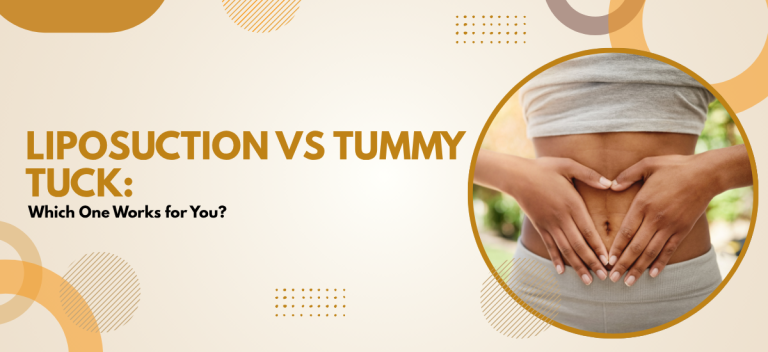 Liposuction vs Tummy Tuck: Which One Works for You?