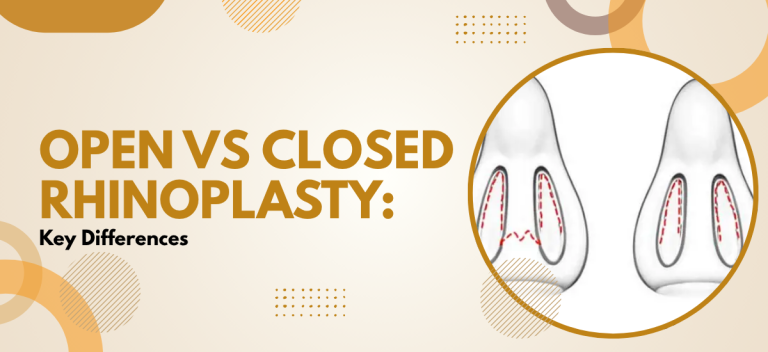 Open vs Closed Rhinoplasty: Key Differences