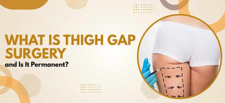 What Is Thigh Gap Surgery and Is It Permanent?
