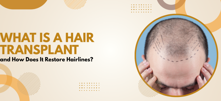 What Is a Hair Transplant and How Does It Restore Hairlines?