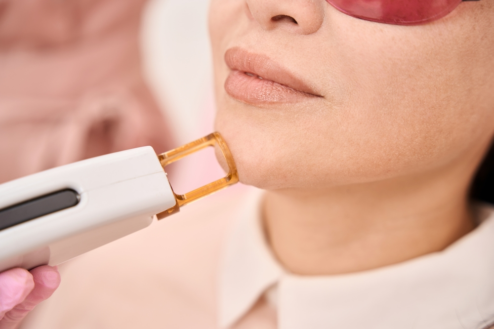 dr monisha kapoor aesthetics skin specialist delhi
