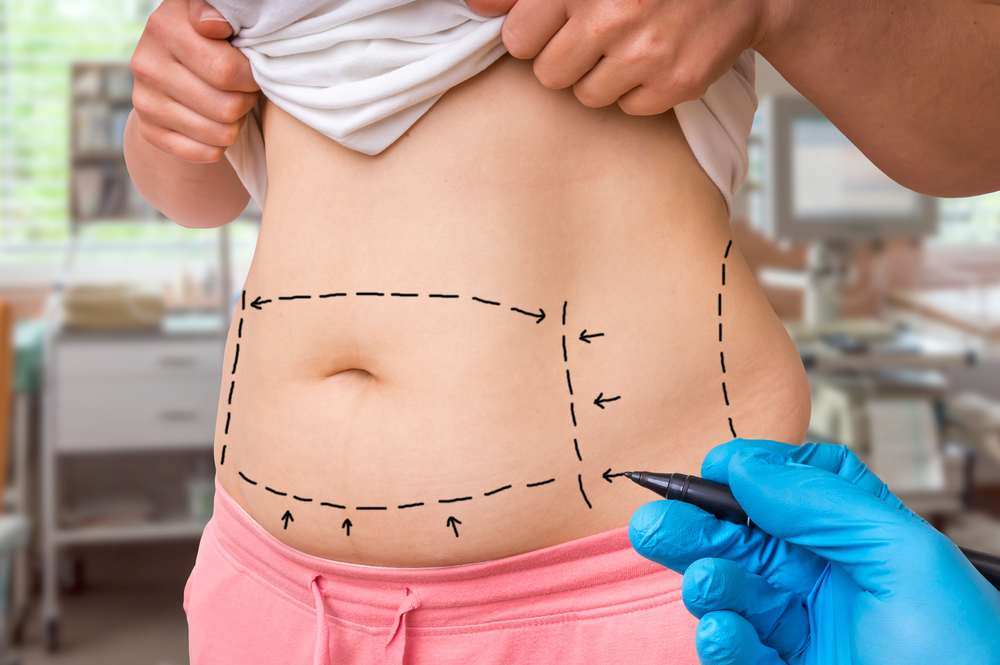 delhi cosmetic surgeon