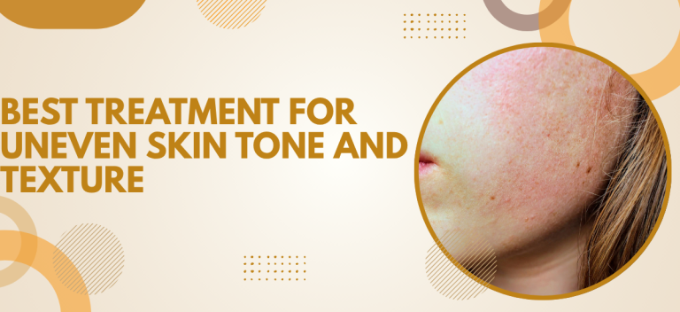 Best Treatment for Uneven Skin Tone and Texture