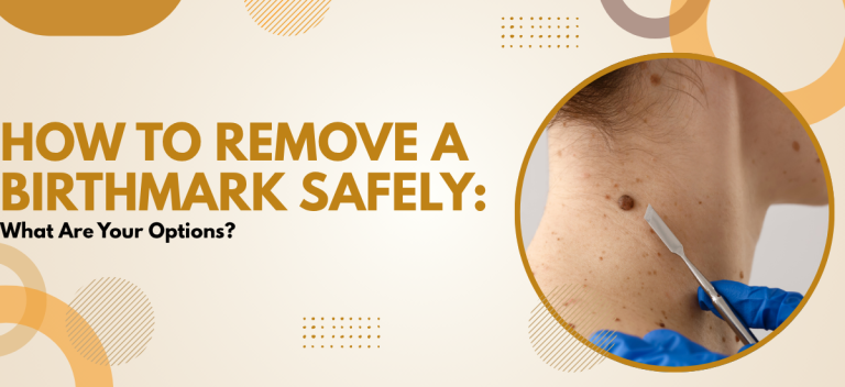 How to Remove a Birthmark Safely: What Are Your Options?