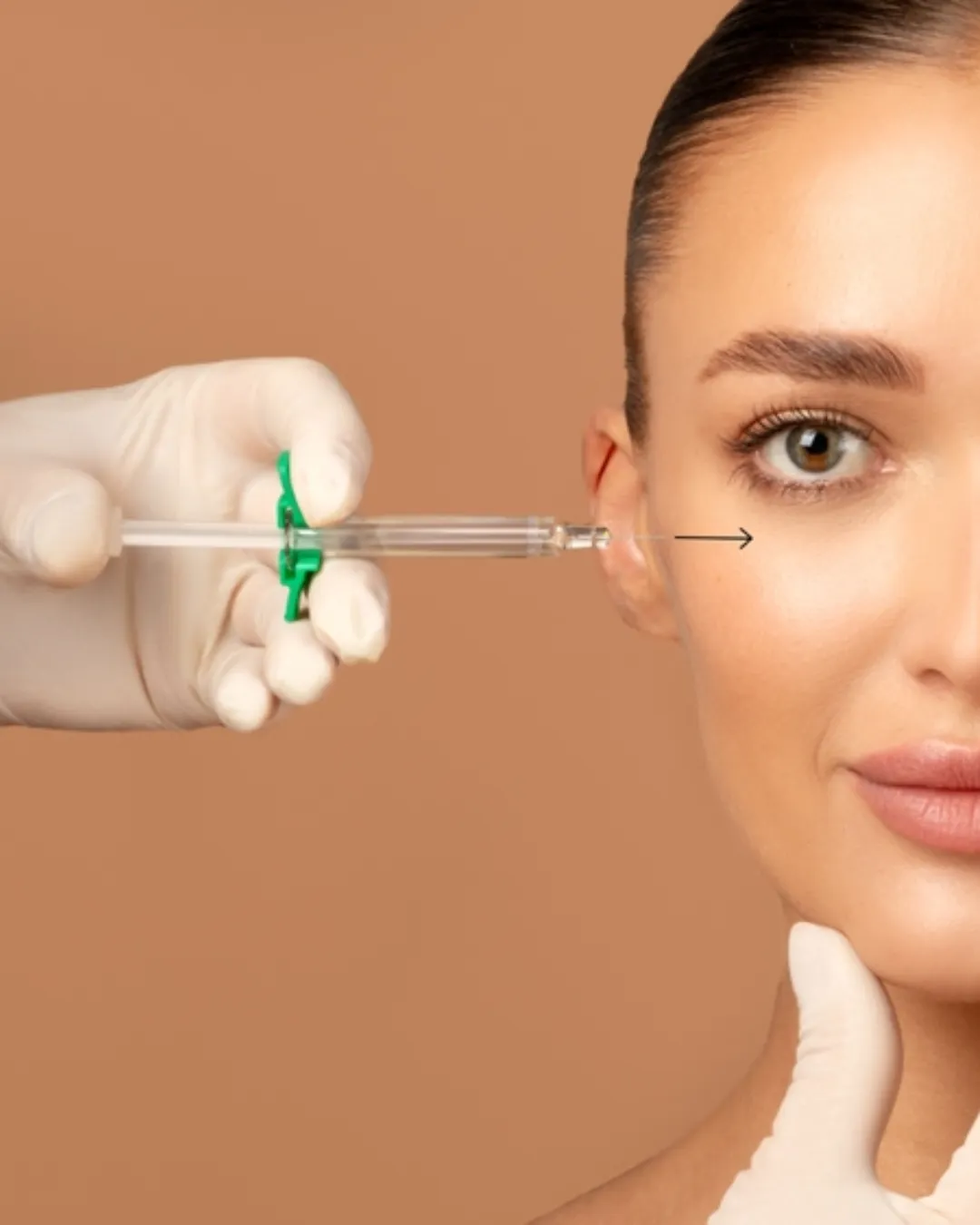 Cheekbone Enhancement